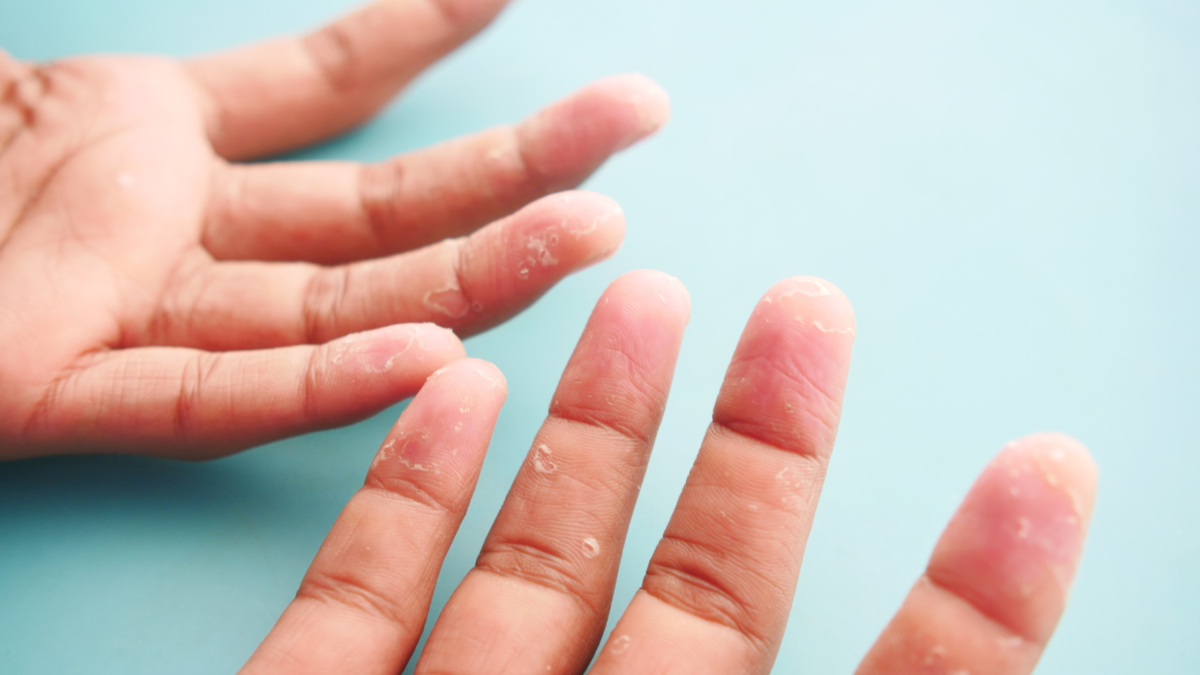 Multivitamin for dry skin