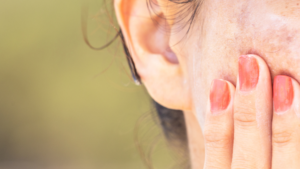 Best Vitamins for Dark Spots