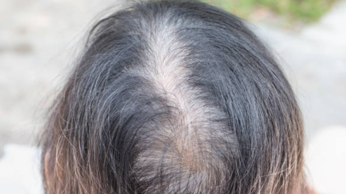 Menopause Hair Loss Why It Happens & 4 Ways to Stop It