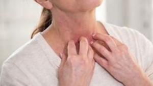 Menopause Itchy Skin Why It Happens & How to Stop the Madness