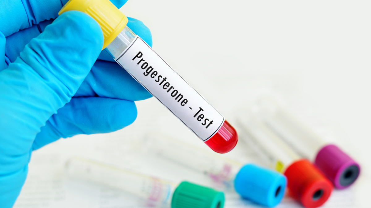 How To Increase Progesterone Naturally