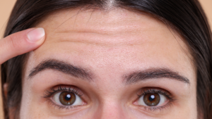 Anti-wrinkle skin care