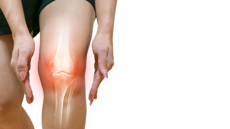 Herbs for Joint Pain: 10 Powerful Natural Remedies