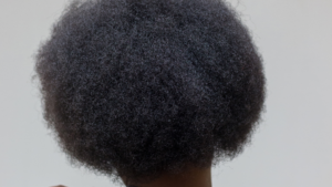 How to Regrow Hair Naturally 12 Proven Methods