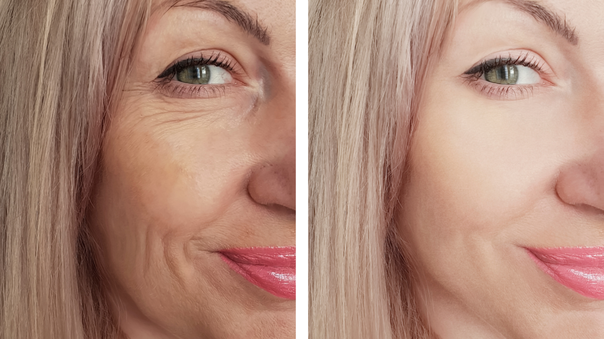 How to Remove Wrinkles from Face Quickly