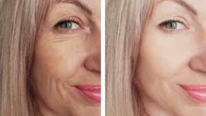How to Remove Wrinkles from Face Quickly
