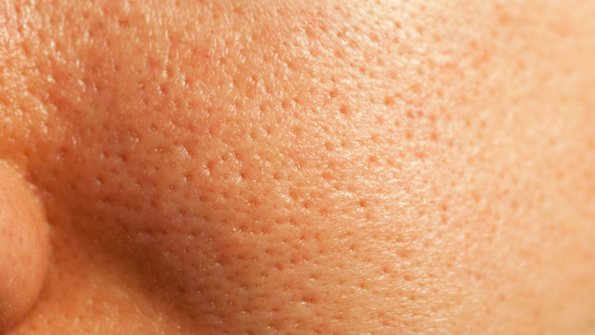 Skin Barrier Repair