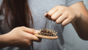 Vitamins to Prevent Hair Loss