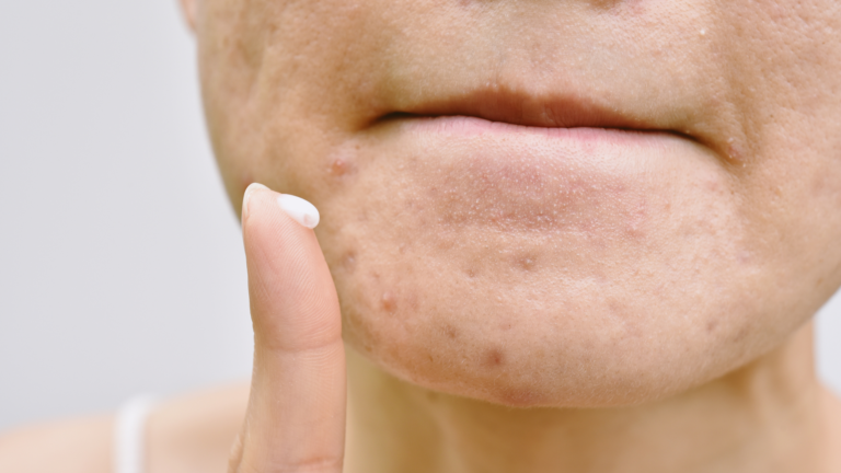 Estrogen Face Cream