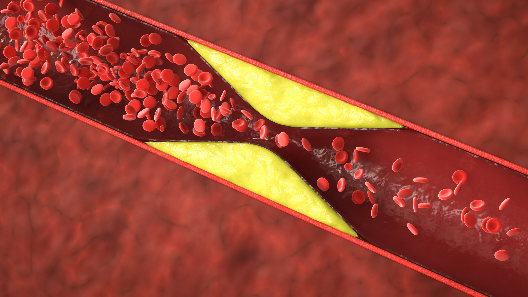 HRT After a Blood Clot