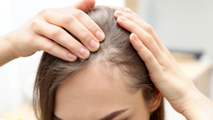 Supplements for Thinning Hair
