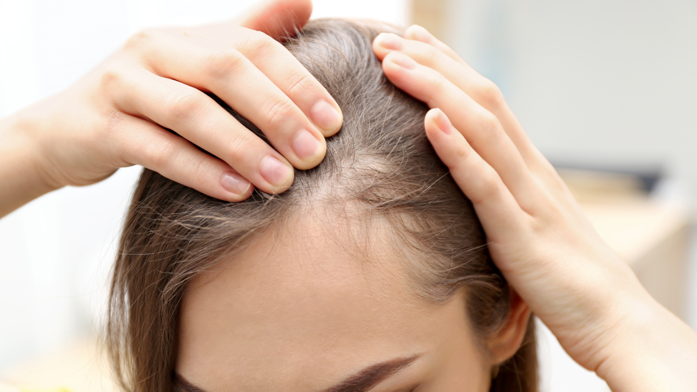 Supplements for Thinning Hair